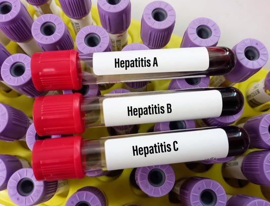 Sur Strip Hepatitis-C