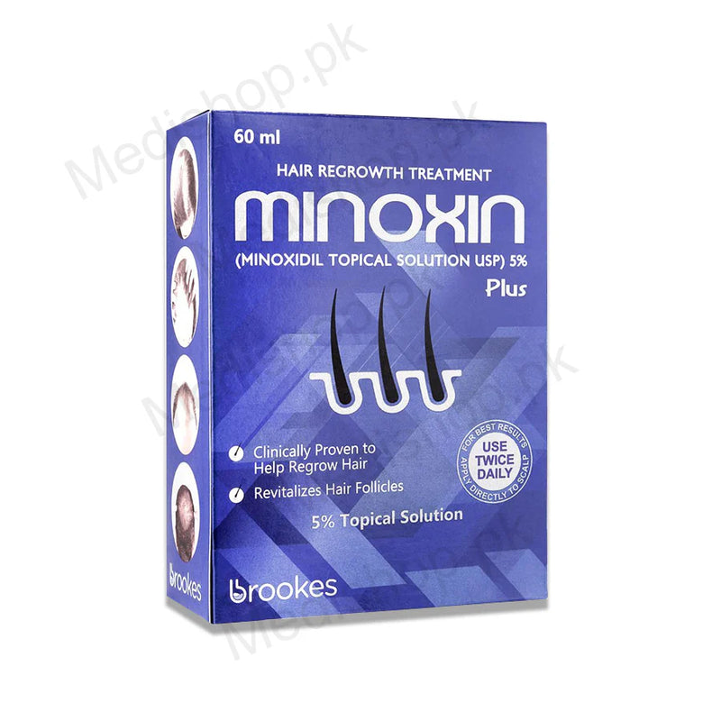 Sol Minoxin 2%